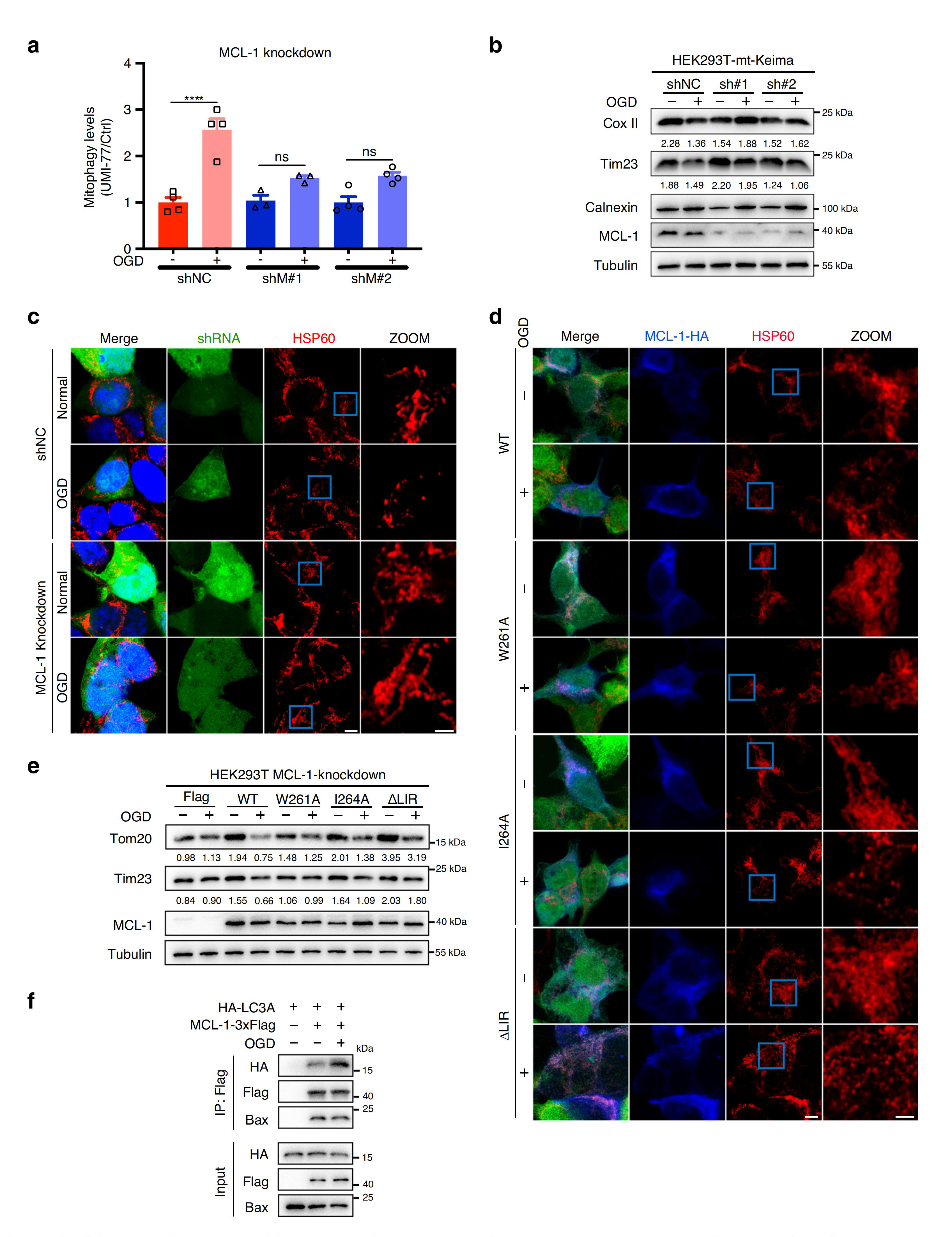 【维真生物】MCL-1是OGD诱导的线粒体自噬所必需的