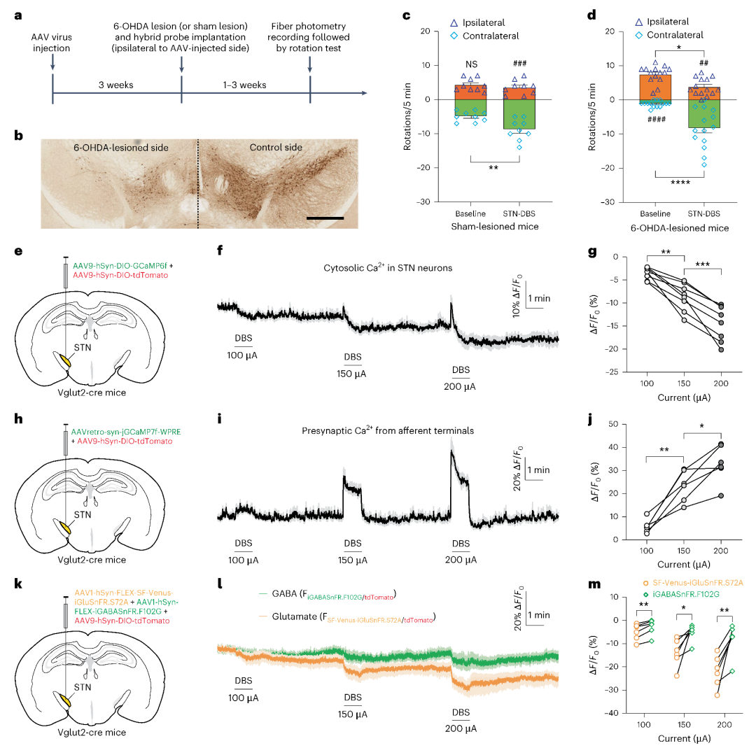 DBS导致STN局部神经递质释放抑制