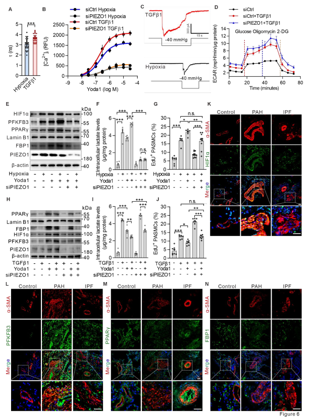 PIEZO1通过HIF1α-PFKFB3或PPARγ-FBP1途径对SMC糖酵解的差异调节